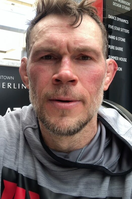 Forrest Griffin