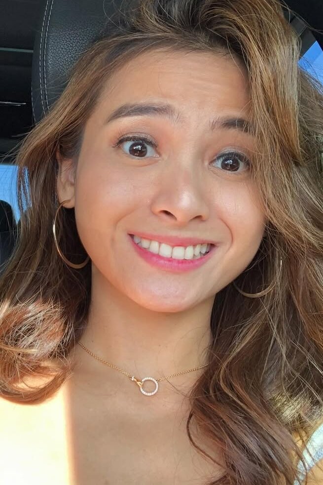 Acha Septriasa
