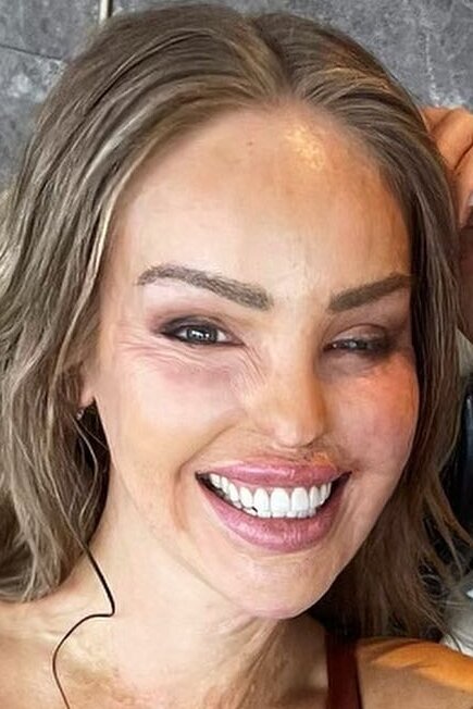 Katie Piper