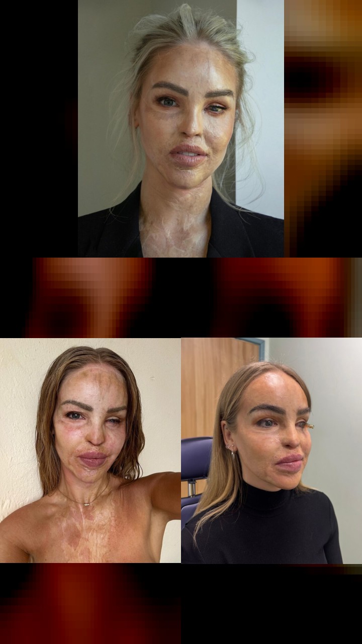 Top 10 Instagram Moments of Katie Piper