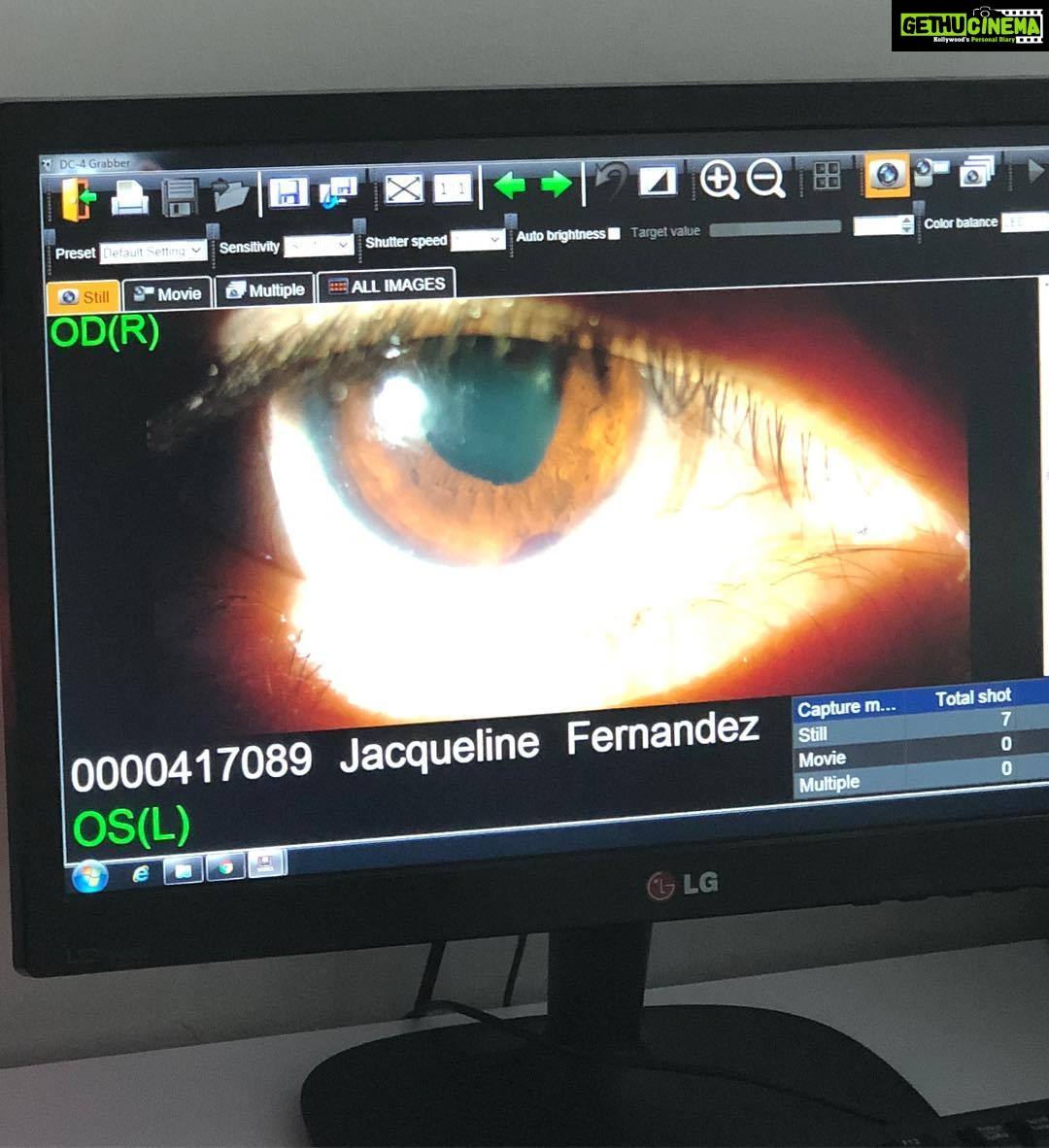 Jacqueline Fernandez Instagram - So it’s a permanent injury and my iris will never be a perfect round again but so so grateful I can see!! #race3 memories ❤️❤️ #abudhabi