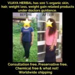 Rachita Ram Instagram – @vijayaherbal has 100 % organic skin,hair,weight loss,weight gain related products under doctors guidance.
They also have for stretch marks ,natural hair removal etc
Their products are preservative free & chemical free. 
Iso 9001:2015,GMP,FSSAI,Organic production certified 
They ship all over  and have happy clients world wide .
The reviews are simply amazing .check it out

DM them to receive free consultation from doctor herself ! Get Natural affordable result oriented products in your hands now ! 
www.digvijayaherbals.com Bangalore, India