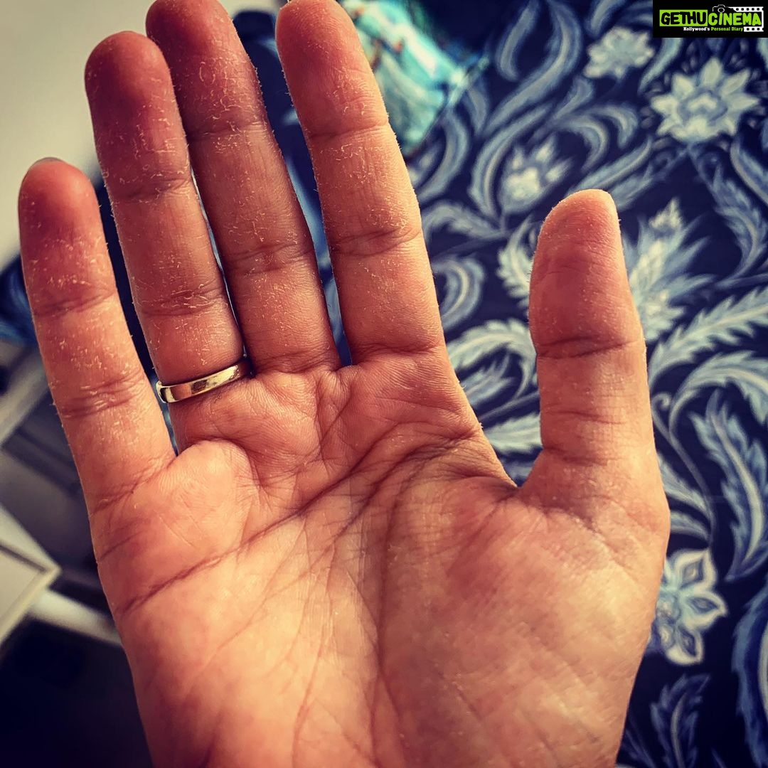 Rubina Dilaik Instagram - Learning lessons a “hard way” - so here are some tips :- 1.) please apply moisturiser as often as possible 2.) wear gloves while cleaning 3.) trim your nails short 4.) rub coconut oil before going to bed ..... (my grandma said) I have started to 🙄.......