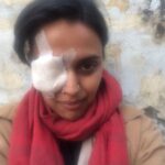 Swara Bhaskar Instagram - Lo! Ab aankh mein lag gayi!! Koi nazar utaaro Meri !! :( :( #dukhiaatmaa #woundedatwork #battered #workmode #AnaarkaliAaraawaali