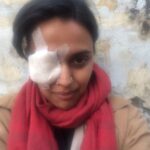 Swara Bhaskar Instagram – Lo! Ab aankh mein lag gayi!! Koi nazar utaaro Meri !! :( :( #dukhiaatmaa #woundedatwork #battered #workmode #AnaarkaliAaraawaali