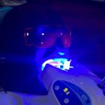 Yogi B Instagram – My wisdom tooth was causing discomfort and pain these past months hindering my vocal performance. I’m so thankful to Dr Yogi, of @tcare_dental , for solving my problem. She also did composite filling on my other teeth then scaling, polishing and whitening.😬👌🏽
My sincere thanks to Dr Yogi for an excellent service and consultation on proper dental care and understanding. I highly recommend you give her a call for your dental health. I am so relieved now. 😁