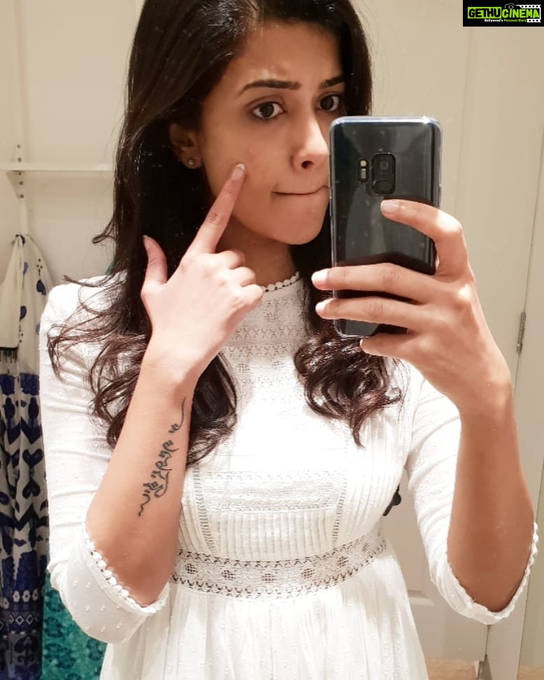Anju Kurian Instagram - Thanks for coming out on photo day, my beloved pimple.