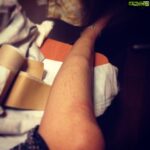 Poonam Kaur Instagram – Hurt myself at shoot today ! Dashed scooty into church wall ! Left leg and right jaw! Lolz showing off …