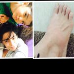 Shweta Bhardwaj Instagram - #recovring from the flu now i twisted my #foot swelling pain cant walk limping oopppsss