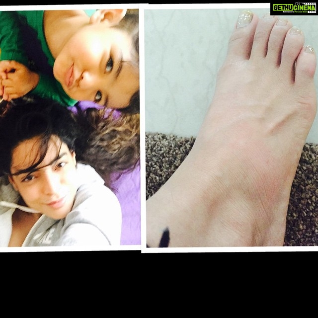 Shweta Bhardwaj Instagram - #recovring from the flu now i twisted my #foot swelling pain cant walk limping oopppsss