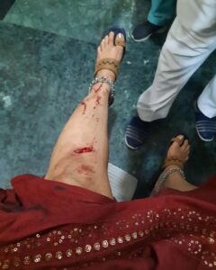 Tanushree Dutta Instagram - Today was an adventurous day!! But finally did make it to Mahakaal darshan..Freak accident on my way to temple...brake fail crash.. . Got away with just a few stitches...Jai Shree Mahakaal!