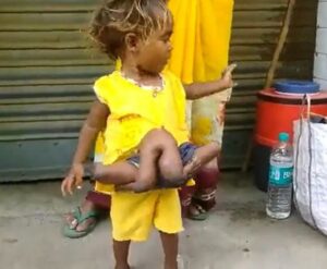 Sonu Sood Instagram - मेरा और चौमुखी कुमारी का सफ़र कामयाब रहा ❤️🙏
Chaumukhi was born with four legs and four hands in a small village in bihar. Now she’s ready to go back to her home after a successful surgery.