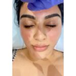 Samyuktha Menon Instagram – All times are the right time for Self Love ❤️
@thereforeim.in 

#skincare #favourite #prp #microneedling #thereforeim Therefore I’m