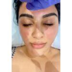 Samyuktha Menon Instagram – All times are the right time for Self Love ❤️
@thereforeim.in
#skincare #favourite #prp #microneedling #thereforeim Therefore I’m