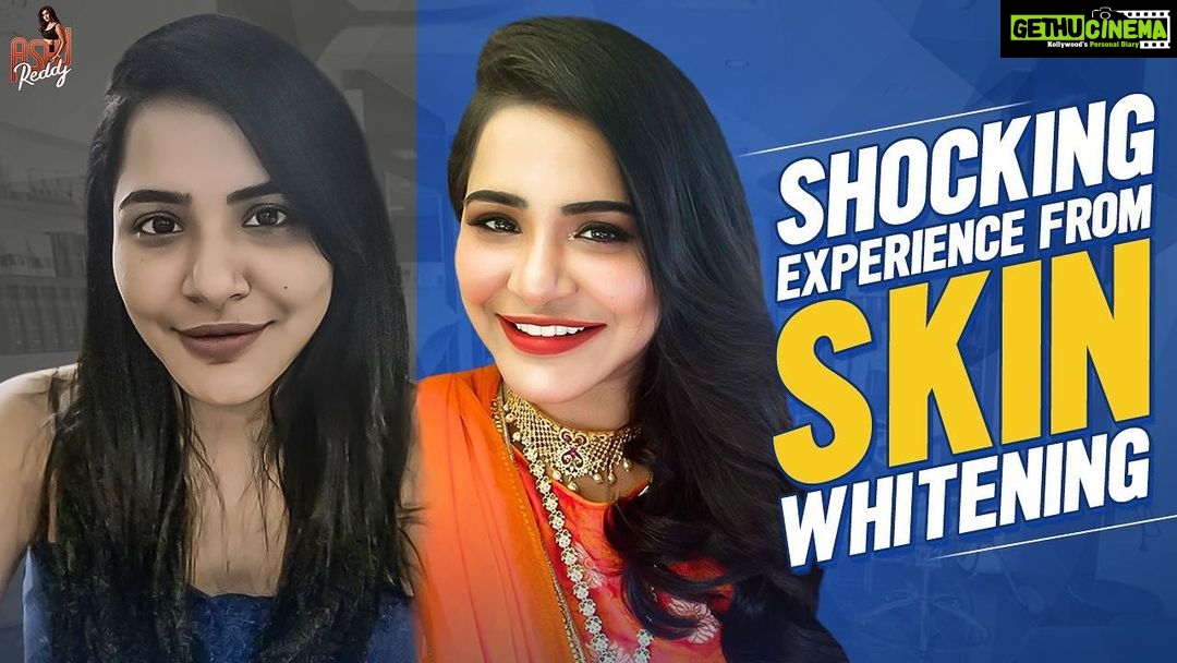 Ashu Reddy Instagram - Skin Whitening!! Will be useful for someone somewhere, watch it now!! Link in bio ❤️❤️ #skinwhitening #ashureddy @tamadamedia @celebritysecretsindia 🌹