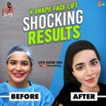 Ashu Reddy Instagram - Watch my YouTube channel for the V shape face lift. Link in bio. @celebritysecretsindia @tamadamedia #keepingupwithashu