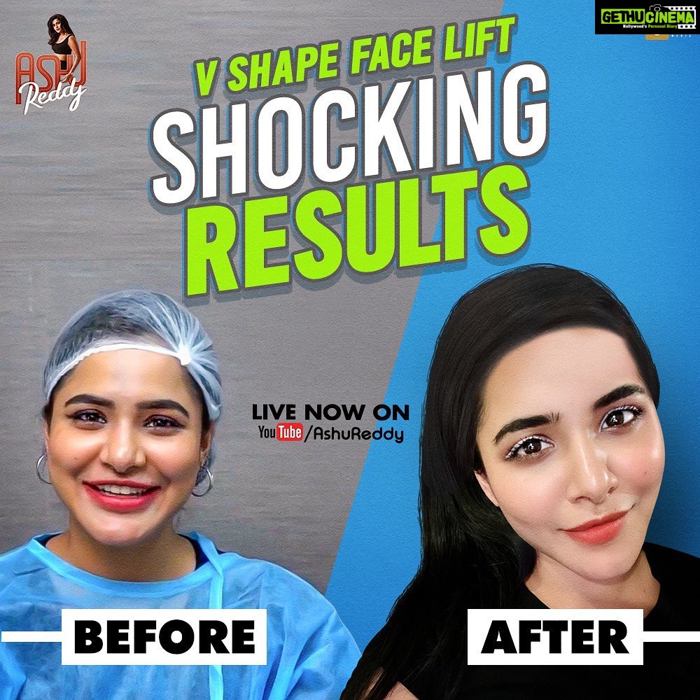 Ashu Reddy Instagram - Watch my YouTube channel for the V shape face lift. Link in bio. @celebritysecretsindia @tamadamedia #keepingupwithashu
