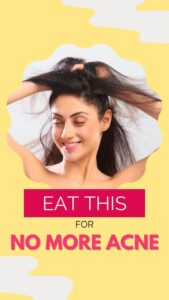 Gurleen Chopra Instagram - DULL SKIN ? ACNE ? PIMPLES ? FACIAL HAIR ? EAT THIS & SEE MAGIC IN FEW DAYS WATCH FULL VIDRO ON YOUTUBE IMGC…. @counsellingwith.gc