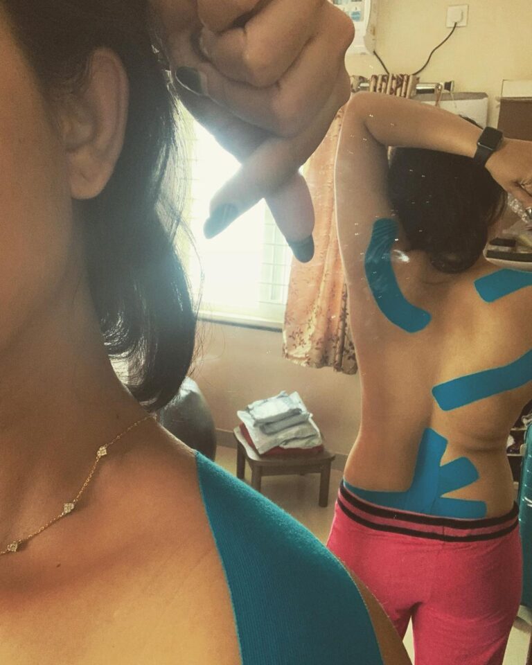 Kalpika Ganesh Instagram - My journey towards healing my body hasn’t been an easy ride Right from Dry Needling / IFT / Manual Traction / Machine Traction / Hot Packs / Manual Massages / Screams / Shouts / Pains / Triggers / Numbness / Nerves Catch / Right Hand & Right Leg feeling numb / Driving with Left Hand / Cooking with Left Hand / Strengthening Exercises / Mobility Exercises / Medicines for Spasms /Managing all the Filth around me with Grace / Eliminating Family & Friends / Entertaining / Travelling for promotions with Shitty airlines services @allianceair.9i / Insta Live to Boost others / Dealing with Educated Asses / Enjoying my Food that I make / Dancing when I feel like / Having min 6 cups of COFFEEE / Sleeping & Waking up at ODD times coz of the meds / Taping so that I can drive back home and do my regular routines and the list goes on 3 months of recovery is what I have been told by Dr. Kapil from @jayaphysioclinics From sessions going from 1-5 hours a day On my 27th day of recovery I do feel much lighter much healed Lot more to go SPONDYLITIS- Degeneration of Bone happens to every human hitting 30 And it varies from muscles issues to nerves From identifying the root cause Dr Ankita Dr Sudeeshna Dr Bhuvana have been doing top notch job in taking care of me every minute And Suresh anna for providing me oka manchi Filter Coffee post sessions Loving this journey As I have always been a physically active kid trying every sport every dance form I never knew muscles have to be relieved always thought good sleep food and hot water bath massages always helps Glad I’m gaining so much more knowledge about my body and making it easier to heal further No Pity No Sympathy Only Will Power and Strength is what I need Start to listen to your body head to your nearest physio if you in to other activities apart from walking and jogging and house hold chores Coz they need attention Breathe Will Hit Back as a Bouncer in less than 3 months surely🥰 #muchlove From Tapped Back🥂 #physiotherapy #physio #heal #rejuvenation #breathe #listentoyourbody #acknowledge #letitheal