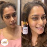 Keerthi shanthanu Instagram - #21daysglowchallenge @thetribeconcepts 24K Kumkumadi Thailam has been my holy grail. It works the best for my skin to give that glowing & healthy look. As you can see, my skin looks dull and not so great in the left image and the right image is my skin after taking up the 21 days glow challenge with the 24K Kumkumadi Thailam. My skin is super glowy and dewy. Few drops of this amazing facial oil to my day/night routine leaves my skin feeling supple and nourished. One brand that sells best quality at an affordable price while giving wonderful results is The Tribe Concepts and I am definitely pinning this product to my routine. I challenge you guys as well to take up the 21 day challenge with the 24k Kumkumadi Thailam and you will know why I’m raving about it. Do tag your friends and challenge them as well!