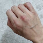 Tina Desai Instagram – Day 1 of boxing lessons. I got these bruises inspite of wearing boxing gloves and also a cloth wrapping beneath that. I’m so proud of it! Lol!!!