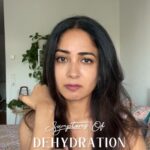 Aditi Chengappa Instagram - SAVE & SHARE! That headache could be dehydration ! . . . #health #healthtips #fitness #nutrition #wellness #coach #diet #yoga #healthy #healthyfood Berlin, Germany