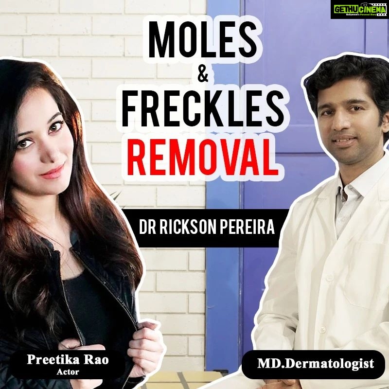 Preetika Rao Instagram - Flat Moles and Raised Moles both can grow bigger in size if home remedies are tried for cure ! Lime Stone, garlic application on the Moles will for surely make the Moles bigger by triggering the Melanin content as personally observed by me. Hemopathy medicines to treat Moles also trigger the Melanin content and can make the Moles bigger in my personal experience. Mole Removal Creams don't work! Let's find out if moles can be permanently removed from today's episode with Celebrity Dermatologist Dr Rickson Pereira. Check the video link in Story👆 #mole #moleremoval #freckles #flatmoles #moleremovaltreatment #warts #wartstreatment #wartsremoval #moleskin