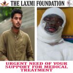 Vikrant Massey Instagram - ✨ WARNING: THE FOLLOWING IMAGE MAY BE GRAPHIC FOR SOME VIEWERS. SWIPE AT YOUR OWN DISCRETION 🙏🏽✨ 🛑 URGENT!!! 🛑 Prince - an acid attack survivor needs urgent medical support. This boy with a million dreams is now in the ICU lying down fighting hard. He is responding to the treatment, yet there is no activity of the body. His parents do have big dreams for him but their account needs your support so that the boy Comes back to life again and fulfills his dream. PLEASE DO SUPPORT IF YOU CAN. 🙏🏽 https://www.impactguru.com/fundraiser/help-prince-raju-sahu Account name- THE LAXMI FOUNDATION Account number- 083105003082 IFSC code -ICIC0000831 Branch - Laxmi Nagar City - Delhi Contact:- +917252827774 +918595282507 E-mail :- thelaxmifoundation@gmail.com #stopsaleacid #thelaxmifoundation #abladnahai #acidattackviolence #acidattacksurvivors #treatment #donation #urgent # alert #medical #gujurat #Coronavirus #handwash #challenge #besafe #spreadpositivity #aware #healthministry #healthylife #stayhome #staysafe #needshares