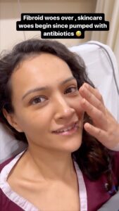 Dipannita Sharma Instagram - Home finally after a surgery which was supposed to be minor but became a major one , since I was in the OT for 6 hours … For me a sort of a #lifeevent 🙏🏼fibroids although common can get complicated so kindly do not ignore ladies . Each woman’s body is different & can react to things differently. I will try to come live or speak about it once I recuperate fully . For now ghar ka verrrrry light food & some nibbles once in a while , which my friends/fam have been generous enough to send ♥️ Thank you for all your messages , for checking on me & warm wishes…will help me recuperate sooner than soon I’m sure … 🥰❤️
@dilsheratwal thank you for cheering me up or at least attempting to pre/post & continuing to … 😄❤️
All the love much needed & appreciated… 
P.S - tried to pose from hospital bed ( can’t take that away from me ) haha . Also still worried more about skincare, since skin feeling dry due to the antibiotics ( just very serious girl things 😀) 
Also decided to use this music because by the time I get ok the dance trend will be over & I’ll never be able to use this music & I love it so much !!! 😁
#postop #homefinally #fibroidfree