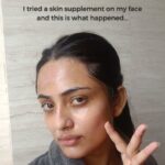 Shritama Mukherjee Instagram – I tried @tgmbeauty_ skin supplement (Glow Inside Out Powder) on my face and my skin felt absolutely nourished, smoother, hydrated and healthy from within post the mask. Everything this skin health-boosting powder supplement does to the skin on the inside, it did to my skin on the outside.

Link in bio to check it out! 🤓 FYI our #SummerSale is on 🎉 so you can grab up to 55% off on our products. 

#tgmbeauty #skinsupplement #skincareinsideout #beautyinsideout #holisticbeauty