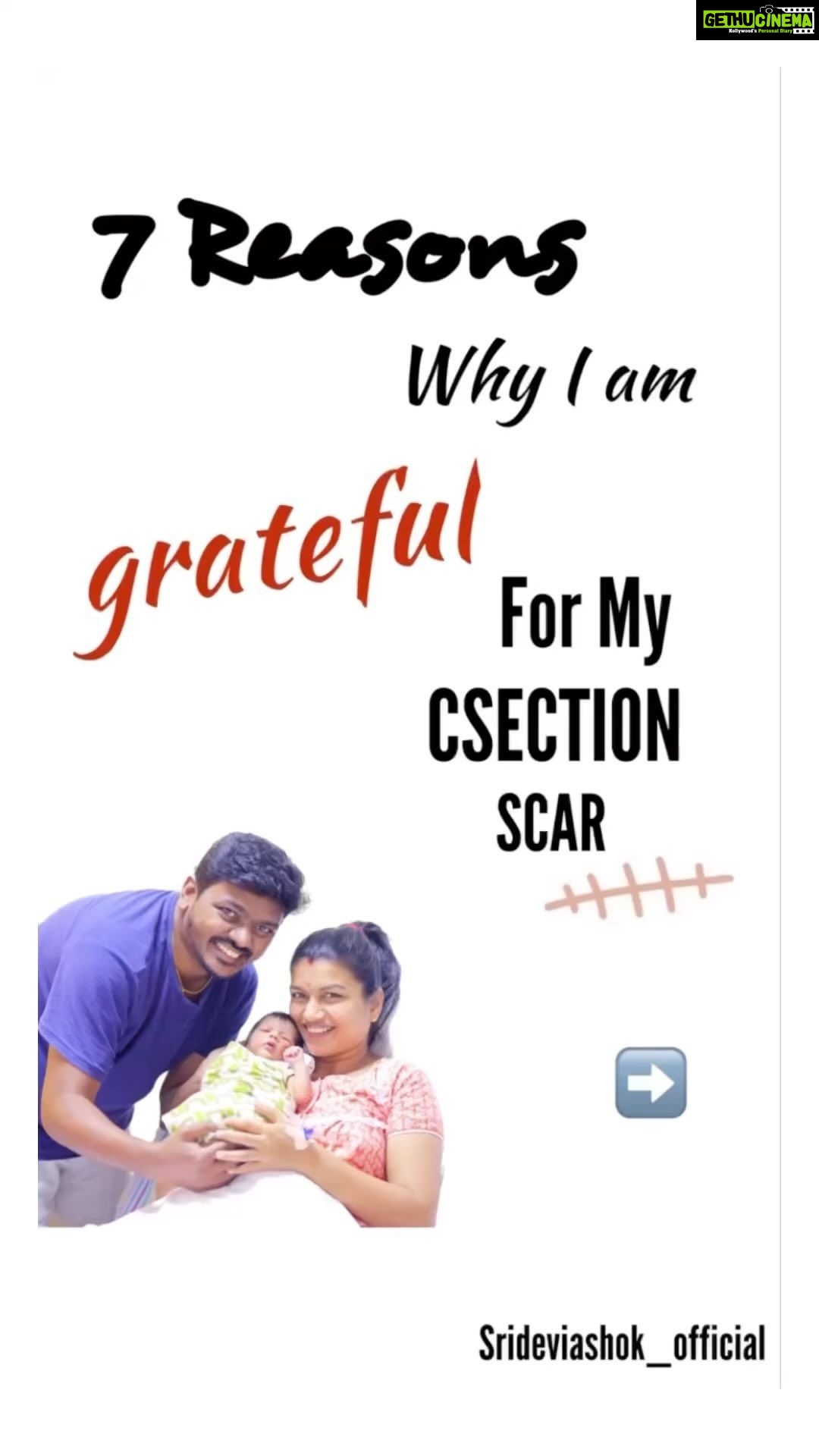 Sridevi Ashok Instagram - Share if this resonates! People need to see this, so we can normalize it. Millions of women get C-sections and we really don’t discuss it at all. It’s important that we normalize it that so many people have the scar, and that you get that little piece of fat there, and it’s whatever, it’s fine.” It’s not just the scarring that goes undiscussed. Most childbirth classes include only a passing mention of C-section, if they cover it at all. That leaves a statistical one third of expectant mothers totally unprepared for the procedure they’ll ultimately undergo. During a C-section, a surgeon slices through the abdominal wall and its attached muscles, then makes a second incision in the uterus. Once the baby and placenta are delivered, both are stitched back up. For as long as six weeks, recovering mothers aren’t able to engage their core muscles at all. That means things like sitting, standing, or lifting a newborn are nearly impossible to do without help. For a couple weeks it hurt pretty badly. I would have to do things like take the baby and lift her to nurse her. They gave me medicine, but the medicine made me feel so foggy, and I wasn’t really sure how gentle I was being with the baby. I couldn’t really feel her weight, and she was so light. It made me feel so nervous to hold her on this medication that I just really didn’t take it. Giving birth should be one of the peak experiences in a woman’s life. As a society we really need to support these mothers and give them the best experience possible, even when things get complicated. In many ways, women have begun taking control of the narrative around C-sections, working to reduce the stigma, correct the misconceptions, and make it clear that becoming a mother is something to celebrate, even when it leaves a scar. It’s a symbol of triumph, and a reminder of what she’s capable of. “I feel like I fought a battle with life, and this time, I won,” “It’s a battle scar.” . . . . : : : #srideviashok Image references: Mommysbundle Content references: harpersbazar