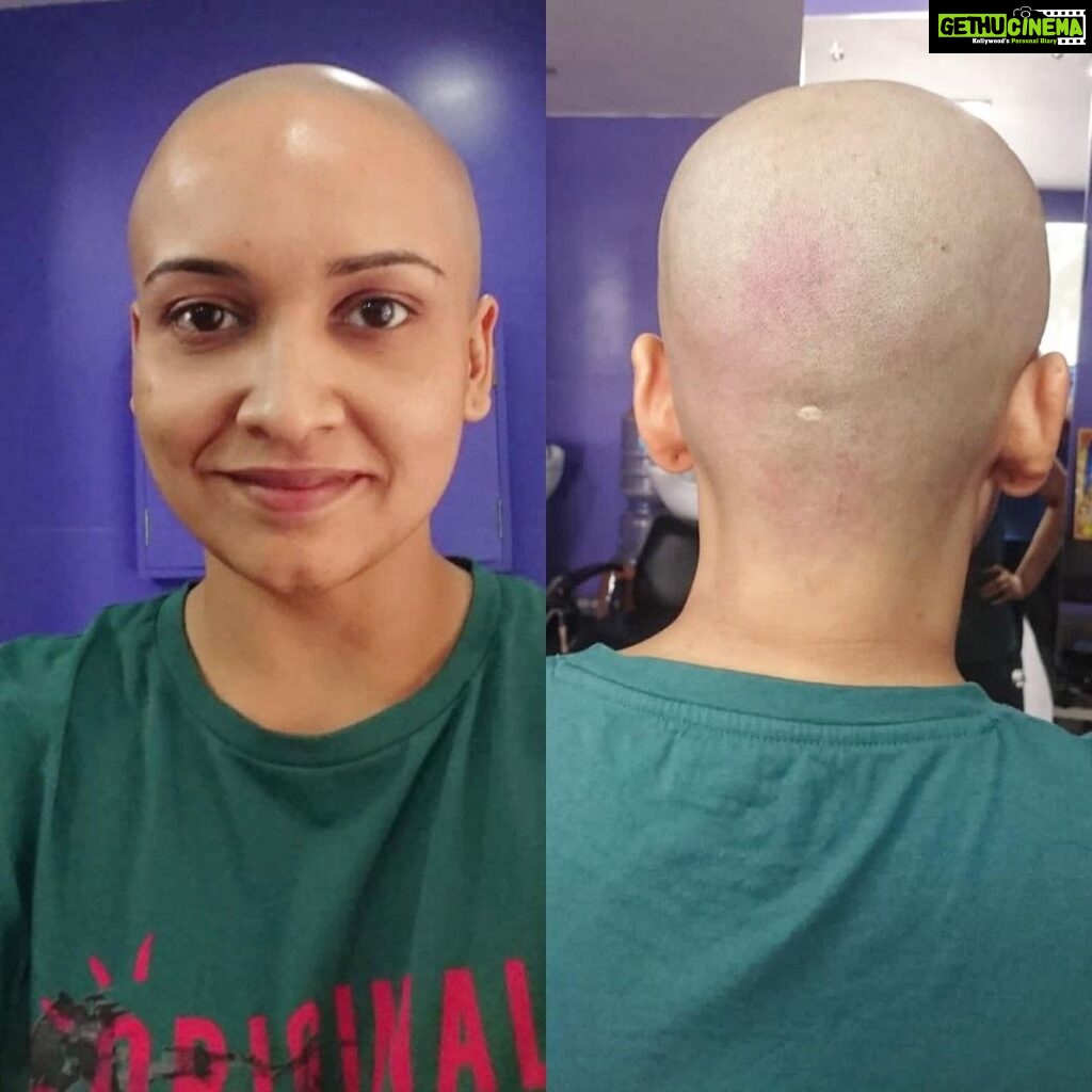 Lena Kumar Instagram - When my hair was shaved off we found proof of ‘The Matrix’ deprogramming plug in 😁. Check the scar on the back !! #The #Matrix #Neo #scar #throwback