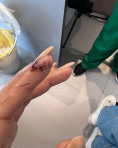 Mimi Chakraborty Instagram - Some days just dosen’t go how you plan it🪡🏥💊🧿📿