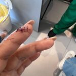 Mimi Chakraborty Instagram – Some days just dosen’t go how you plan it🪡🏥💊🧿📿