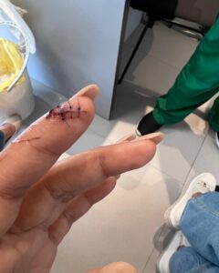 Mimi Chakraborty Instagram - Some days just dosen’t go how you plan it🪡🏥💊🧿📿