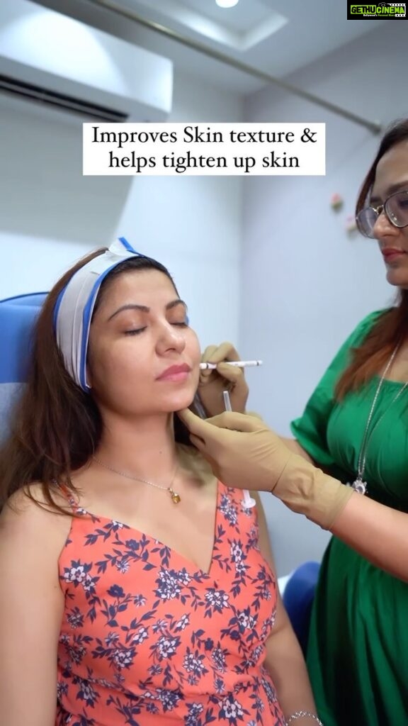 Geet Gambhir Instagram - PROFHILO - Bio Remodelling of Skin About the Treatment Profhilo Treatment is a highly purified injectable hyaluronic acid skin booster. With special patented NAHYCO® technology, Profhilo functions to hydrate the skin from inside, like an internal moisturiser, and stimulates the production of elastin and collagen. Together this helps improve skin tone and skin laxity and results in glowing, radiant, smooth skin. Procedure 20 minutes numbing cream and injectables are performed on five points on each side of face. Results There will be noticeable hydration but actual results will start showing after one week. Downtime. Subtle swelling in face for 24-48hours. Thanx to my aesthetic Doctor @drnehabatra for helping me achieve the desired skin ♥ . . . . . . . . . . #skintreatment #aesthetic #doctor #profhilo #bioremodelling #skin #skintexture #hydration #hyaluronicacid