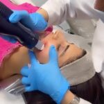 Vindhya Tiwari Instagram - Thank u @queensbydrumaira love love love this ❤️ with every treatment my skin is becoming smooth n healthier #mnrflaser #fractionallaserresurfacing …Highly recommended ⭐️⭐️⭐️⭐️⭐️