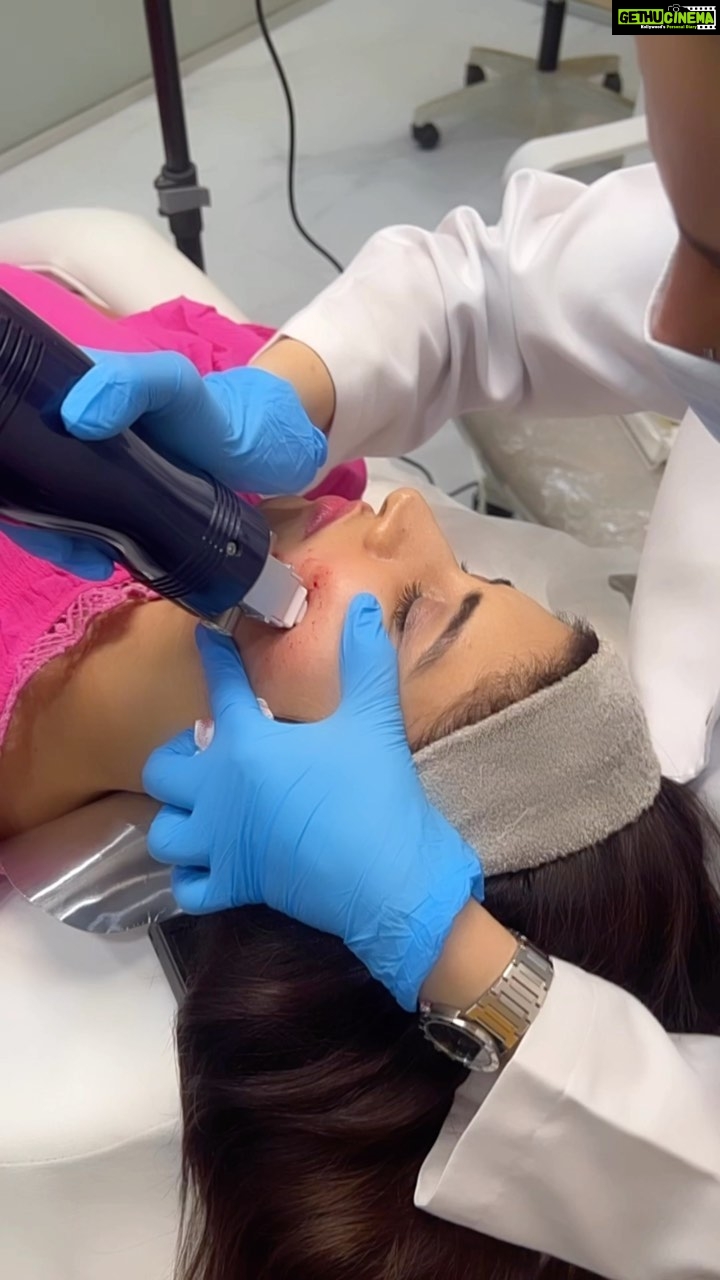 Vindhya Tiwari Instagram - Thank u @queensbydrumaira love love love this ❤️ with every treatment my skin is becoming smooth n healthier #mnrflaser #fractionallaserresurfacing …Highly recommended ⭐️⭐️⭐️⭐️⭐️