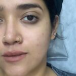 Abhirami Suresh Instagram – Like they say boost is the secret of my energy, my skin secret is @skinsecretsclinic eee! And the favourite @dr_anjanamohan ♥️😘
