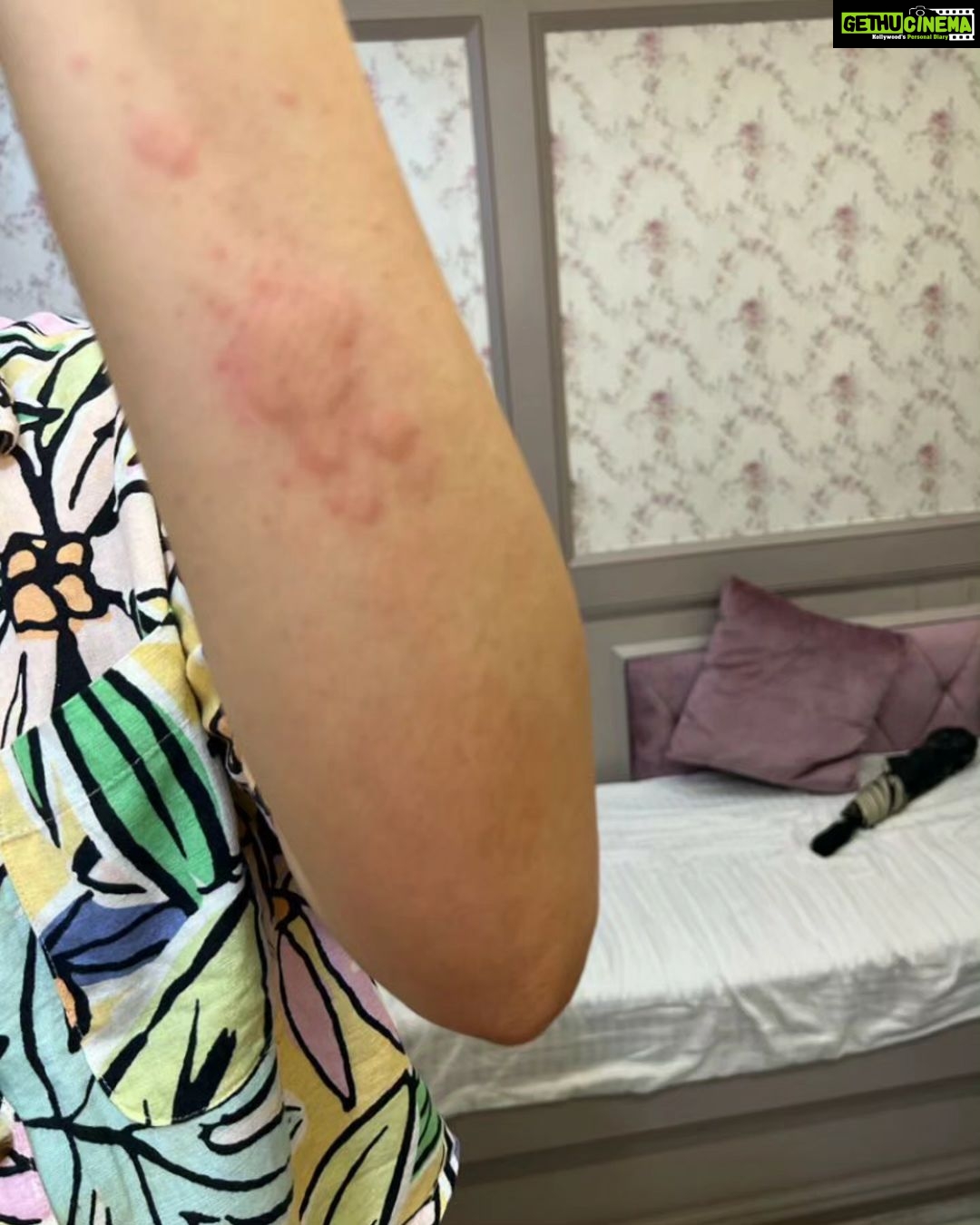 Adah Sharma Instagram - Thank u sabko...Kahan Kahan se I got messages and kuch log Jo itne saal se I haven't met also , also adah fan clubs ❤️❤️ Disclaimer :DO NOT SWIPE IF YOU ARE SCARED OF RASH ON SKIN IMAGES ,thode daravne photos hai 😬but i thought sirf Sundar pics share nahi karne chahiye on instagram na 😅 I've been bimaar kuch din se. Hives aa gaye. Hives yeh horrible rash hai. Toh full sleeves pehen ke hide kar rahi thi..chehere pe aa gaye. Stress se ! So then I took dawai and turns out main allergic hu to the dawai so lots and lots of ulti ho gayi . Toh now ek doosri dawai aur injection leke , full sleeves aur pairon ko cover karke i will do promotions today. Iske baad I promised my Amma I will take care of health. Toh kal,I'm leaving for a few days. Amma ne kaha hai radio trails, zoom interviews , promo shoot sab ho gaya ab health pe dhyaan do. I'm going to do an ayurvedic treatment. I will be back soon. Tab Tak insta pe update karti rahoongi behind the scenes Commando ke . Bhavana Reddy ko Reddy hona next project yehich mahina start horaaah.woh Kya bolthe finger cross ...apna lao continue karke dena ❤️