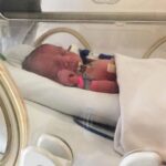 Celina Jaitly Instagram – It took me 5 years to come to terms with this episode of our lives but I have finally summoned the courage to talk about my ordeal to help many parents who reach out to @haag.peter & I as they deal with the trauma of preterm birth and loss of a baby. Peter n I want such parents to know that they can get through this. In personal experience we both can vouch that your Preemie baby is a true survivor. #preemies show us the power of faith & prayer and the fight of the human spirit. Remember that most #prematurebabies survive and live completely normal, healthy lives.
PS: Preterm is defined as babies born alive before 37 weeks of #pregnancy are completed.
The outcome of our 2nd spontaneous #twinpregnancy was bittersweet due to Baby Shamsher’s loss due to a heart condition.( I went into labour at 32 weeks due to my fathers sudden passing.) It was very difficult for Peter n I but we smiled after many million tears in this photograph (1) to seal a happy memory for our blessing baby @arthurjhaag arrival as he went straight to NICU in an incubator for 3 months immediately upon his arrival. The NICU was a strange & difficult environment. From our experience, accepting that there will be good days and bad days will help you to feel less shocked & worried when challenging days happen. While not an option for everyone, Peter & I moved into the same hospital in Dubai for the few months of #nicu as loss of Shamsher left us immensely anxious about Arthur and feelings of frustration, intense sadness, nervousness, disappointment, guilt, anger, love overwhelmed us too. So please know that you are not alone in how you are feeling. Know that extreme & sometimes contradictory emotions are experienced by nearly every parent of a preemie at one time or another. It is very important at such a time to remember you can be more effective as a team than individually so watch your teamwork as parents. Speaking, singing gently to your premature baby in the NICU is a great way to bond and feel close, even when you can’t hold him. Remember Impossible odds set the stage for incredible miracles.
Although the world is full of suffering, it is also full of the overcoming of it.
#celinajaitly
