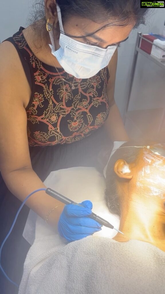 Chinmayi Instagram - We had a client coming to us with an uncommon amount of DPNs, Skin tags and Warts. This is how we treated them! Radio frequency Ablation is a quick and effective procedure that precisely targets and heats the tissue and removes DPNs, Skin Tags and Warts. Want to address your skin concerns and get the best treatments? Book a consultation with our expert dermatologists today! For appointments 📞Chennai +91 7358320111 📞Hyderabad +91 9150598889 Visit: www.deepskindialogues.com #skinglow #skintags #skinrevival #chennai #hyderabad #deepskindialogues #skintreatment #skinlove