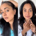 Sameera Reddy Instagram - You’ve all seen the recent tiff I had with adult acne, but guess what? @acne.squad rode in like a knight in shining armor! 🌟 When it comes to skin, you guys know I will always recommend ONLY what works for me and their acne care lineup is like a treasure trove, and here are the stars of the show: The Breakout Terminator spot corrector and the Super Saviour Spot Corrector. 💥✨ The Breakout Terminator? It’s like the superhero of spot correctors, zapping blemishes into oblivion in the blink of an eye! 💥🚀 And then, enter the Super Saviour, making sure those pesky blemishes don’t even think about making a comeback. 🦸‍♂️🔒 Trust me, you’ve got to give @acne.squad a try! These products came in just in time when my breakouts began! 🌈💆‍♀️ Get your hands on these at www.acnesquad.com #AD #AcneHeroes #SkincareMagic