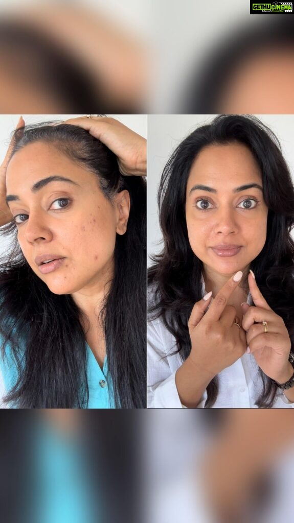 Sameera Reddy Instagram - You’ve all seen the recent tiff I had with adult acne, but guess what? @acne.squad rode in like a knight in shining armor! 🌟 When it comes to skin, you guys know I will always recommend ONLY what works for me and their acne care lineup is like a treasure trove, and here are the stars of the show: The Breakout Terminator spot corrector and the Super Saviour Spot Corrector. 💥✨ The Breakout Terminator? It’s like the superhero of spot correctors, zapping blemishes into oblivion in the blink of an eye! 💥🚀 And then, enter the Super Saviour, making sure those pesky blemishes don’t even think about making a comeback. 🦸‍♂️🔒 Trust me, you’ve got to give @acne.squad a try! These products came in just in time when my breakouts began! 🌈💆‍♀️ Get your hands on these at www.acnesquad.com #AD #AcneHeroes #SkincareMagic