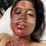Shweta Tripathi Instagram - The journey of Parul in the world of Kaalkoot hasn’t been easy. Meeting the acid attack victims made me realise that now, they are more than the people they were before the incident happened. They showed me the people they are, now. People who despite being burned by hatred, learnt to smile, celebrate, find joy. Survive. Most even forgave. While their attackers got married. Started a family.. Having felt a very small percentage of what they go through while playing Parul made me question myself again and again that why do we do this to anyone? HOW can we let anyone do THIS? When will we STOP?! How bad does it have to get to take us to ACT?! Sirf chere ki baat nahi hai. Baat nazar ki hai. Sapno ki hai. Aaney waley kal ki hai. Sirf ek ki nahi, oski family aur doston ki hai. Yeh sab soch kar kai baar meri rooh mujhe kafa hoti hai. Kya aapki nahi hoti? Thank you and ♥️ you @sumit.saxena.35912 for making me a part of this important story. May you always manage to make us question ourselves!