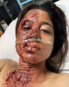 Shweta Tripathi Instagram - The journey of Parul in the world of Kaalkoot hasn’t been easy. Meeting the acid attack victims made me realise that now, they are more than the people they were before the incident happened. They showed me the people they are, now. People who despite being burned by hatred, learnt to smile, celebrate, find joy. Survive. Most even forgave. While their attackers got married. Started a family.. Having felt a very small percentage of what they go through while playing Parul made me question myself again and again that why do we do this to anyone? HOW can we let anyone do THIS? When will we STOP?! How bad does it have to get to take us to ACT?! Sirf chere ki baat nahi hai. Baat nazar ki hai. Sapno ki hai. Aaney waley kal ki hai. Sirf ek ki nahi, oski family aur doston ki hai. Yeh sab soch kar kai baar meri rooh mujhe kafa hoti hai. Kya aapki nahi hoti? Thank you and ♥️ you @sumit.saxena.35912 for making me a part of this important story. May you always manage to make us question ourselves!
