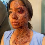 Shweta Tripathi Instagram - The journey of Parul in the world of Kaalkoot hasn’t been easy. Meeting the acid attack victims made me realise that now, they are more than the people they were before the incident happened. They showed me the people they are, now. People who despite being burned by hatred, learnt to smile, celebrate, find joy. Survive. Most even forgave. While their attackers got married. Started a family.. Having felt a very small percentage of what they go through while playing Parul made me question myself again and again that why do we do this to anyone? HOW can we let anyone do THIS? When will we STOP?! How bad does it have to get to take us to ACT?! Sirf chere ki baat nahi hai. Baat nazar ki hai. Sapno ki hai. Aaney waley kal ki hai. Sirf ek ki nahi, oski family aur doston ki hai. Yeh sab soch kar kai baar meri rooh mujhe kafa hoti hai. Kya aapki nahi hoti? Thank you and ♥️ you @sumit.saxena.35912 for making me a part of this important story. May you always manage to make us question ourselves!