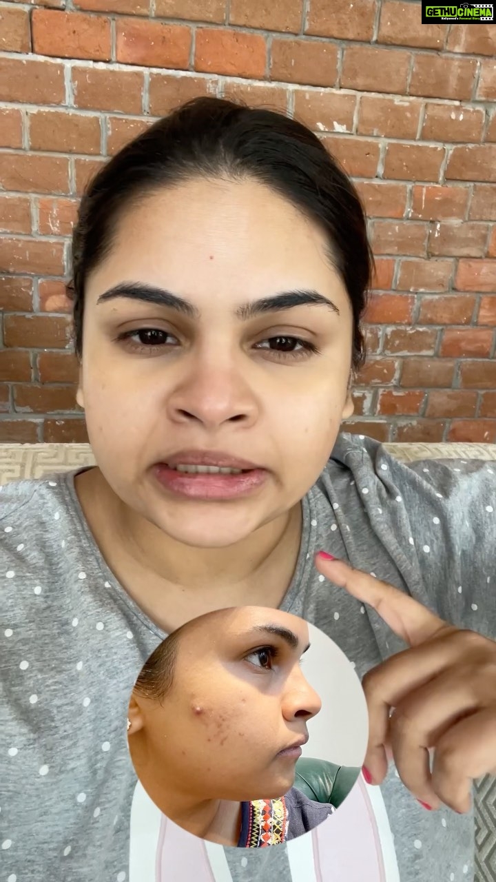 Vidyulekha Raman Instagram - After years of struggling with problematic and acne prone skin, I’ve finally solved all my problems thanks to the experts at @twopointzero.in . They gave me a customised program for my skin needs and I can honestly say this is the best my skin has felt and looked in years. Do check them out to get the skin of your dreams!! ✨🧿 #skin #skincare #skincareroutine #skincaretips #aestheticclinic #skintreatment #acne #acnetreatment #glowingskin