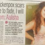 Aalisha Panwar Instagram – #BombayTimes 

Currently suffering from chickenpox and not being able to shoot so for a few while u guys might not see me in upcoming telecast .. 
Need ur good wishes and hope to recover soon so I can come back strong.. ., 😇🙏❣️