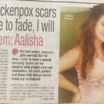 Aalisha Panwar Instagram – #BombayTimes
Currently suffering from chickenpox and not being able to shoot so for a few while u guys might not see me in upcoming telecast ..
Need ur good wishes and hope to recover soon so I can come back strong.. ., 😇🙏❣️